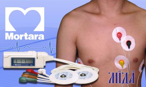 Mortara_Холтер_картинка